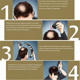 Hair Building Premium Building Hair fibers for hair loss - Iconic Trendz Boutique